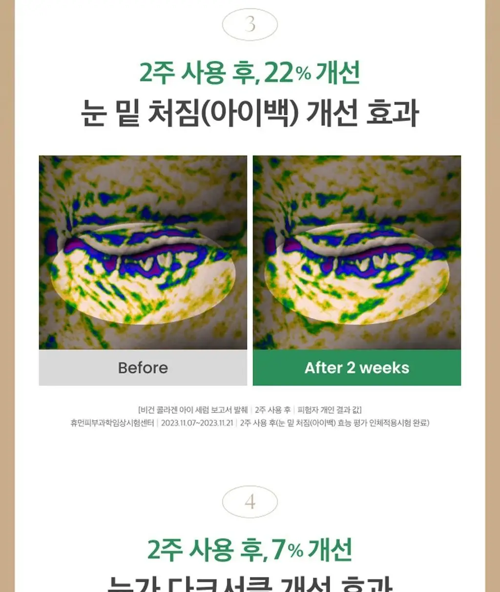 [탱탱아이볼세럼/탄력] 엑시스와이 비건 콜라겐 아이세럼 10ml 상세페이지 9